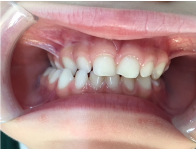 Estética dental en Las Rozas - Centro dental Heron